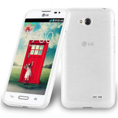 Load image into Gallery viewer, Silber / L70 (1. SIM)