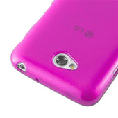 Load image into Gallery viewer, Pink / L70 (1. SIM)