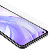 Load image into Gallery viewer, Transparent / Mi 11 LITE (4G / 5G) / 11 LITE NE